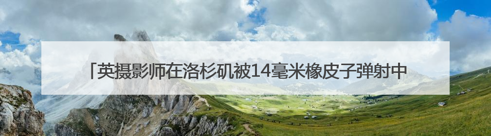 英摄影师在洛杉矶被14毫米橡皮子弹射中大腿 当地华人：像误闯“末日生存”游戏